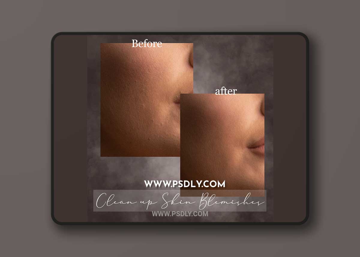 Sweet Soul Studio: Clean up Skin Blemishes Atn