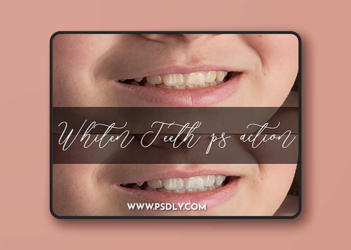 Sweet Soul Studio - Whiten Teeth Action