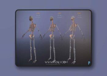 Monsters - Skeleton (4.26+)